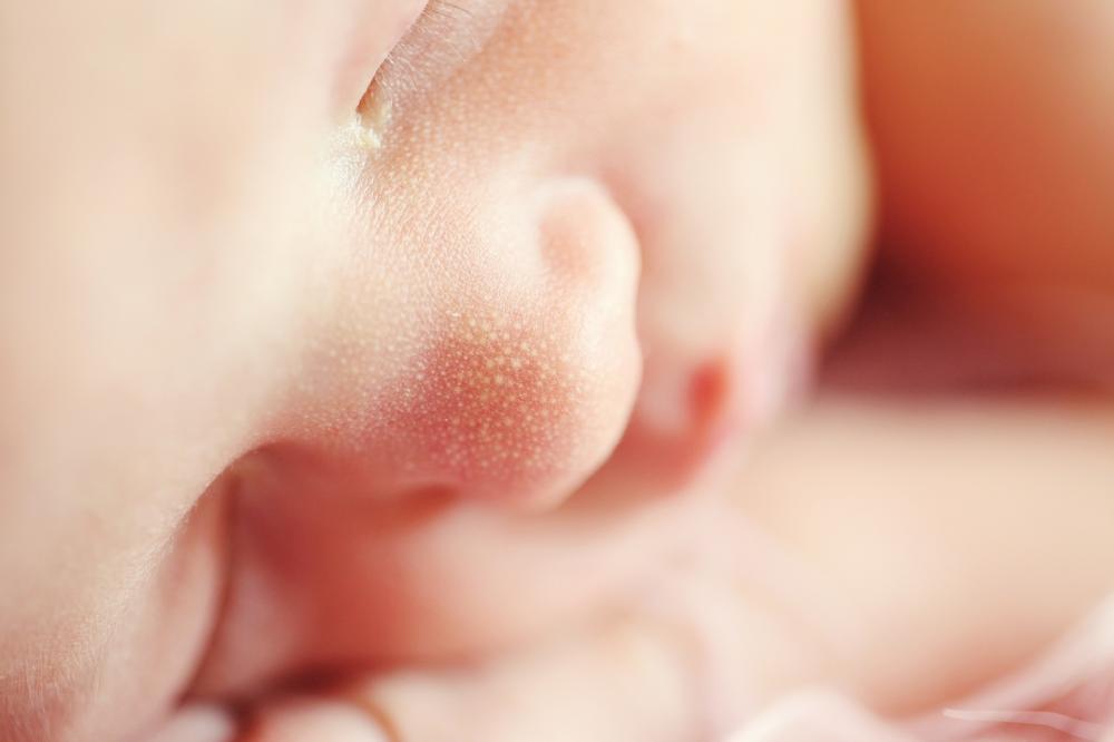 The Weekend Leader - New smartphone app to detect jaundice in babies shows promise