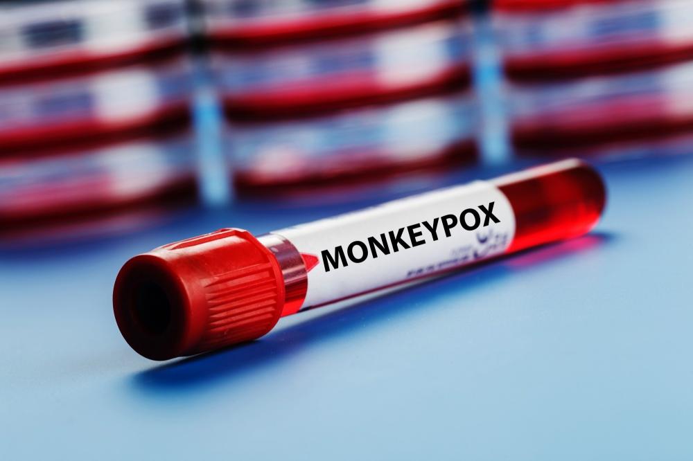 The Weekend Leader - Monkeypox outbreak slowing in US, officials urge caution