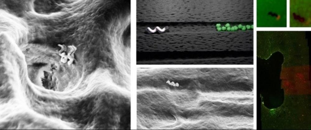 The Weekend Leader - Tiny bots can deep clean teeth: Study