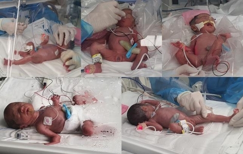 The Weekend Leader - Quintuplets born for 1st time in 34 yrs in S.Korea