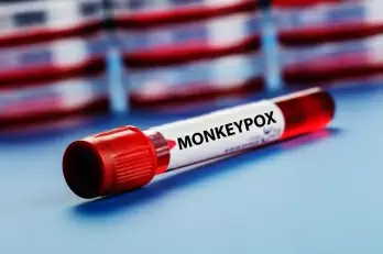 Fear of social stigma preventing Asians from monkeypox testing